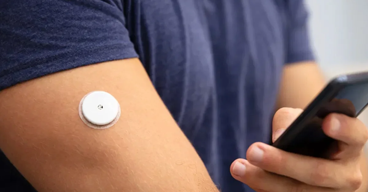 Continuous glucose monitoring device for diabetes
